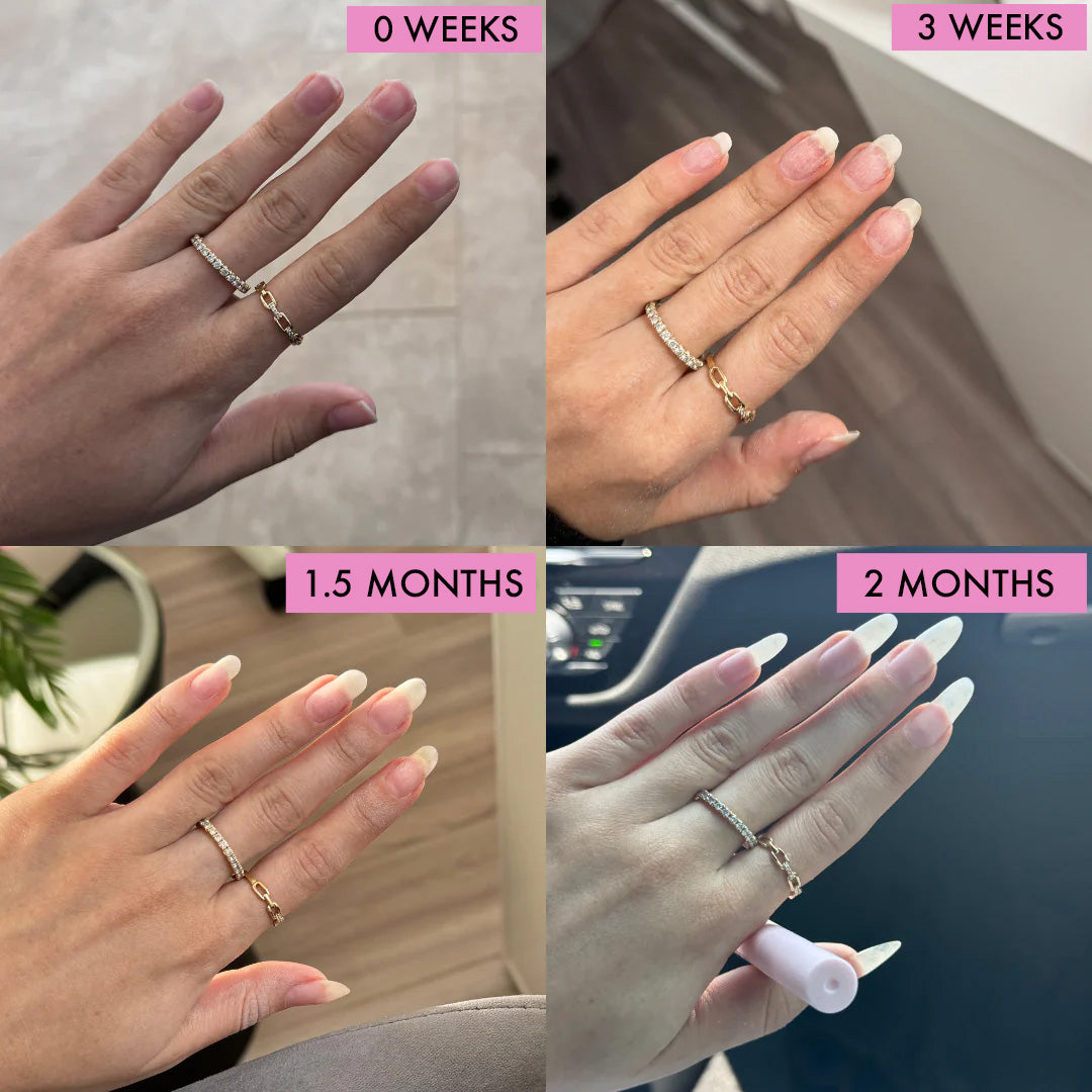 Juve - Nail Growth Serum